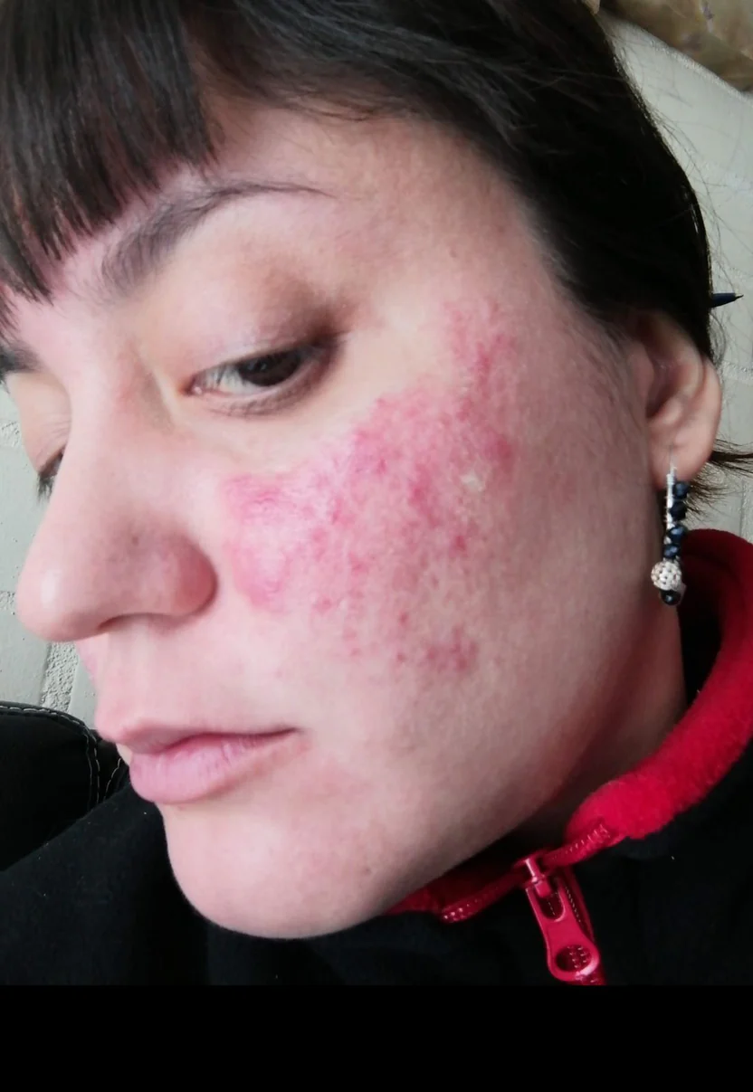 Antes de usar Renova+